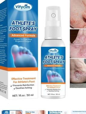 Vifycim Athlete's Foot Spray - Soothing Antifungal Spray set of 3